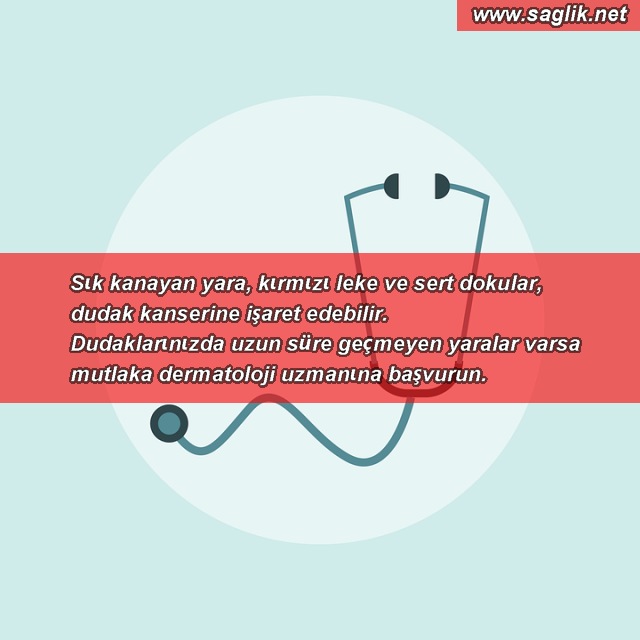 Sık kanayan yara, kırmızı leke ve sert dokular, dudak kanserine işaret edebilir. Dudaklarınızda uzun süre geçmeyen yaralar varsa mutlaka dermatoloji uzmanına başvurun.